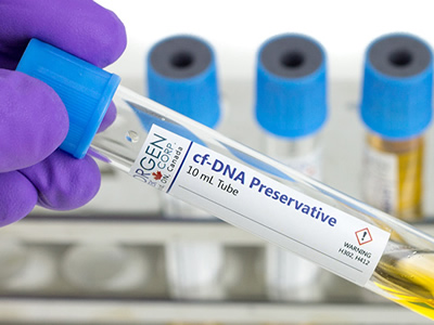 DNA tự do (cf-DNA) và ứng dụng trong điều trị ung thư