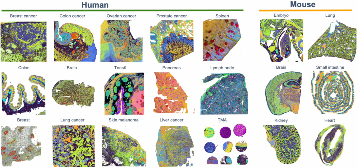Introduction to Visium HD: Spatial biology in high definition